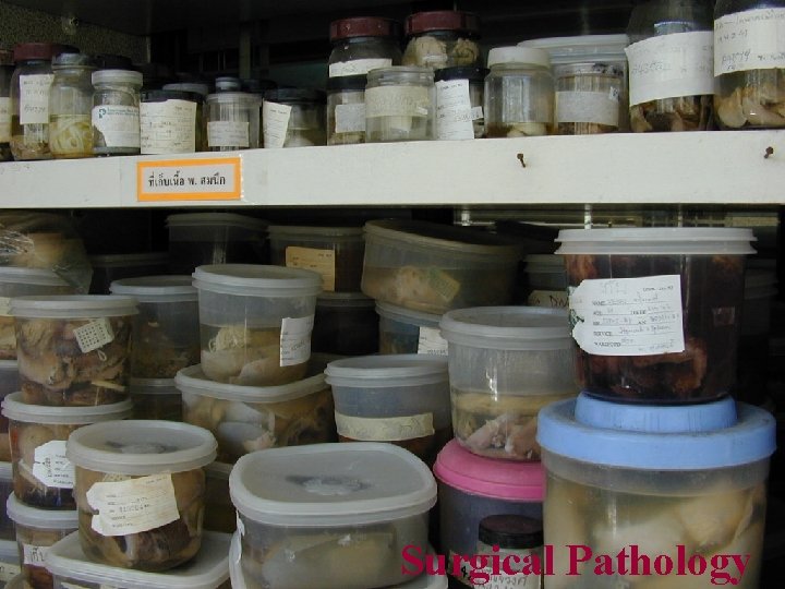 Surgical Pathology 