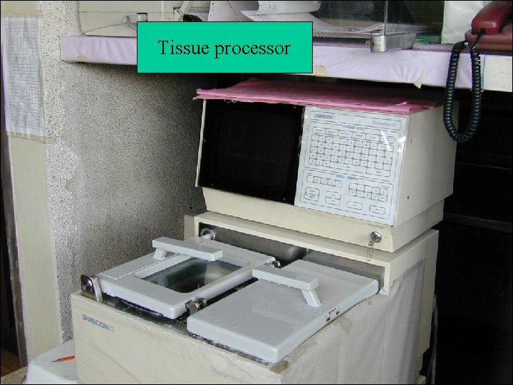 Tissue processor 