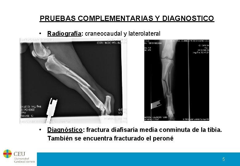 PRUEBAS COMPLEMENTARIAS Y DIAGNOSTICO • Radiografía: craneocaudal y laterolateral • Diagnóstico: fractura diafisaria media