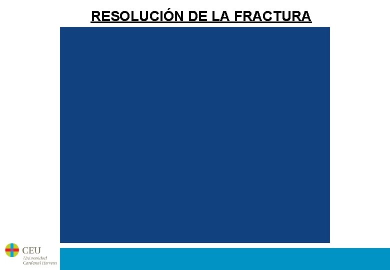 RESOLUCIÓN DE LA FRACTURA 