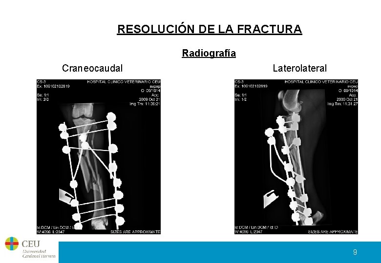 RESOLUCIÓN DE LA FRACTURA Radiografía Craneocaudal Laterolateral 9 