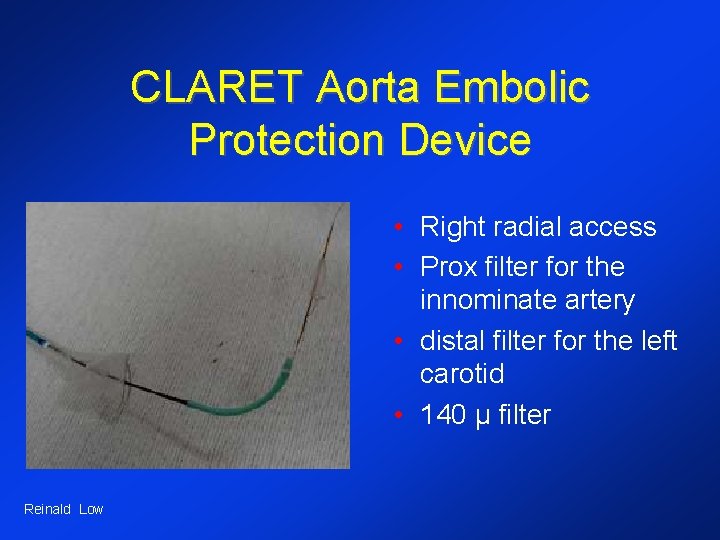 CLARET Aorta Embolic Protection Device • Right radial access • Prox filter for the