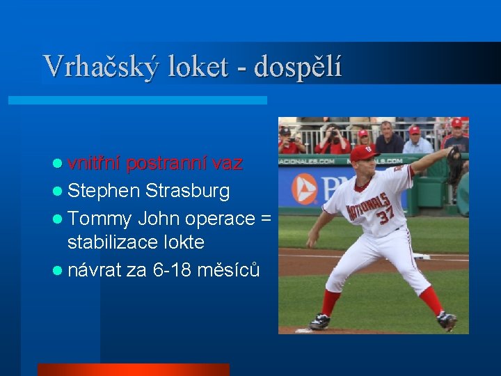 Vrhačský loket - dospělí l vnitřní postranní vaz l Stephen Strasburg l Tommy John