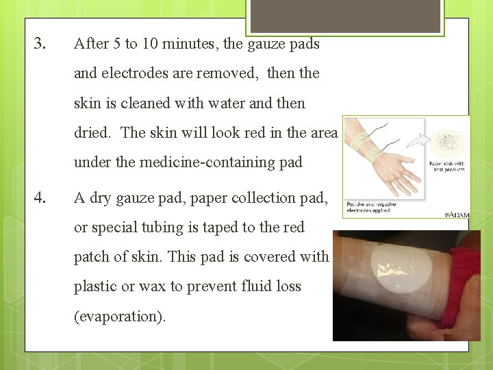 3. 4. After 5 to 10 minutes, the gauze pads and electrodes are removed,