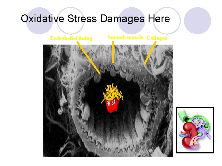 Oxidative Stress Damages Here Endothelial lining Smooth muscle Collagen 