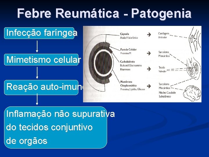 Febre Reumática - Patogenia Infecção faríngea Mimetismo celular Reação auto-imune Inflamação não supurativa do