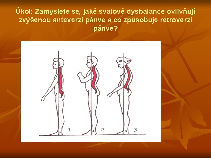 Úkol: Zamyslete se, jaké svalové dysbalance ovlivňují zvýšenou anteverzi pánve a co způsobuje retroverzi