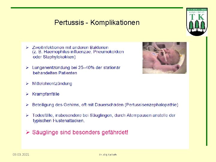 Pertussis - Komplikationen 09. 03. 2021 Dr. Jörg Epstude 