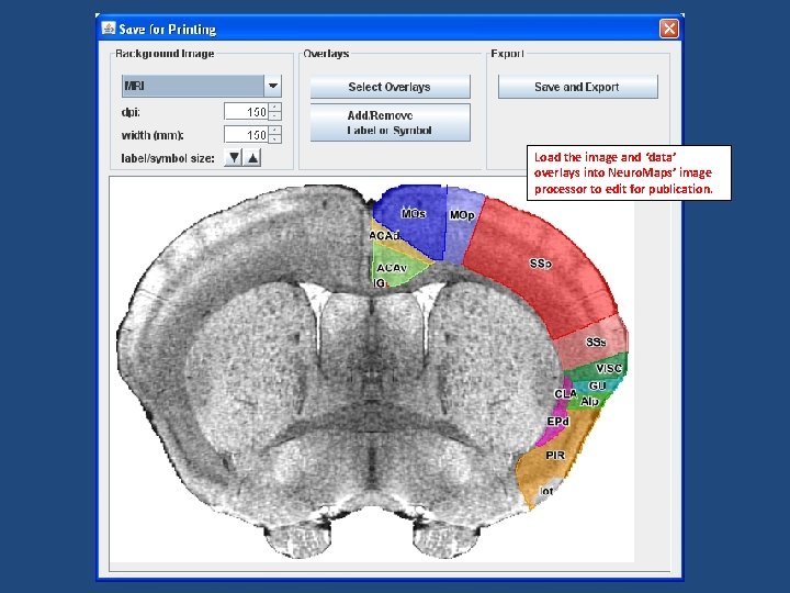 Load the image and ‘data’ overlays into Neuro. Maps’ image processor to edit for