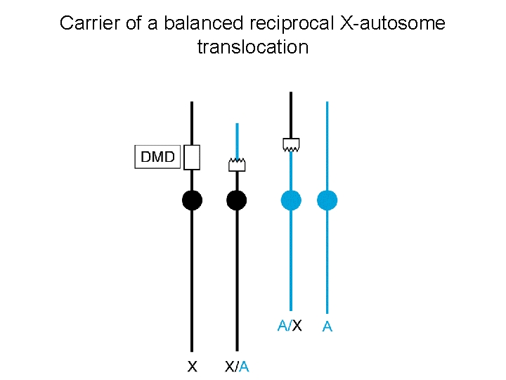 Carrier of a balanced reciprocal X-autosome translocation 