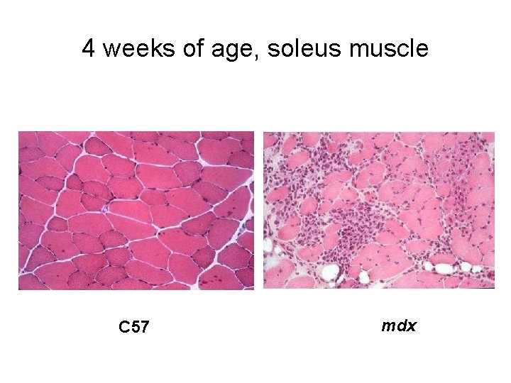 4 weeks of age, soleus muscle C 57 mdx 
