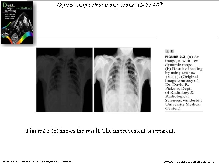 Digital Image Processing Using MATLAB® Figure 2. 3 (b) shows the result. The improvement