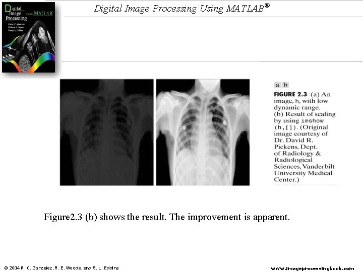 Digital Image Processing Using MATLAB® Figure 2. 3 (b) shows the result. The improvement Digital Image Processing Using MATLAB® Figure 2. 3 (b) shows the result. The improvement