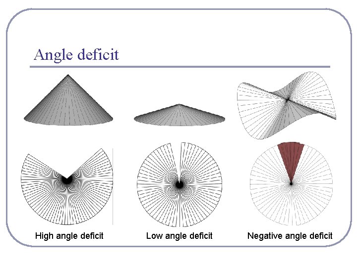 Angle deficit High angle deficit Low angle deficit Negative angle deficit 