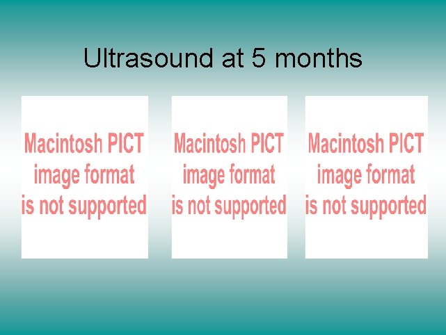 Ultrasound at 5 months 