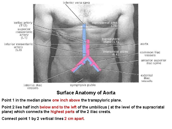 Surface Anatomy of Aorta Point 1 in the median plane one inch above the