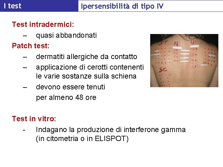 I test Ipersensibilità di tipo IV Test intradermici: – quasi abbandonati Patch test: –