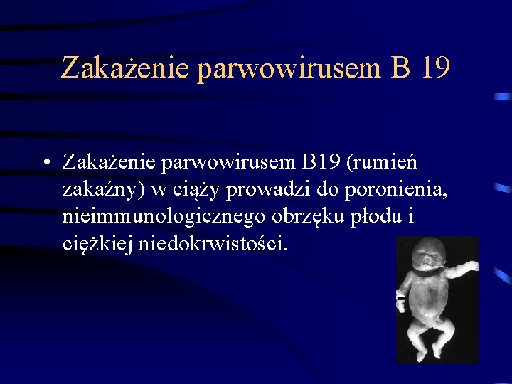 Zakażenie parwowirusem B 19 • Zakażenie parwowirusem B 19 (rumień zakaźny) w ciąży prowadzi