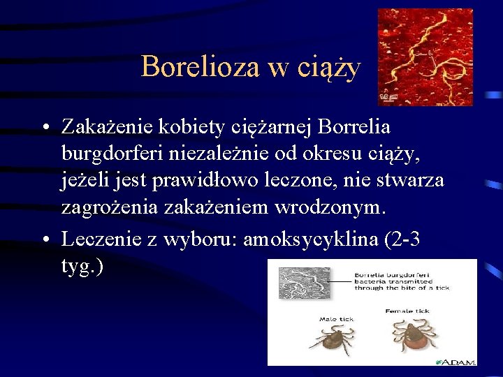 Borelioza w ciąży • Zakażenie kobiety ciężarnej Borrelia burgdorferi niezależnie od okresu ciąży, jeżeli