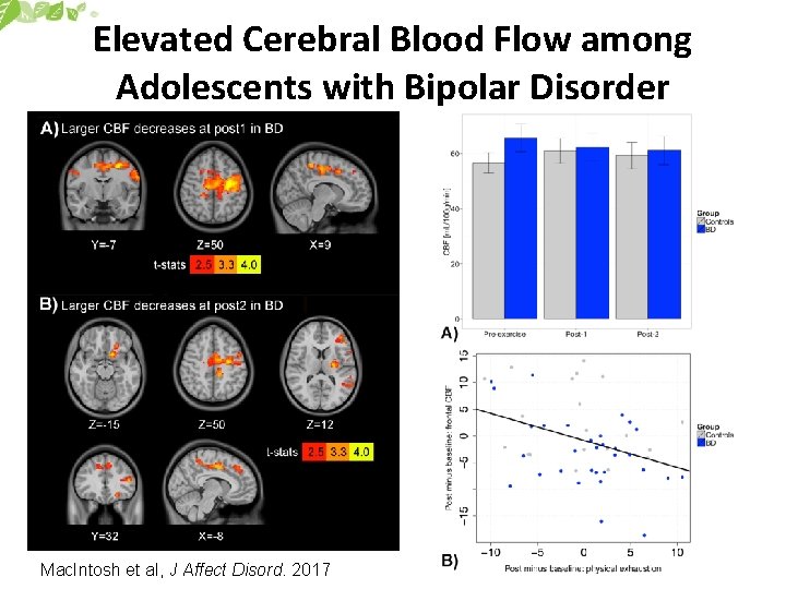 Elevated Cerebral Blood Flow among Adolescents with Bipolar Disorder Mac. Intosh et al, J