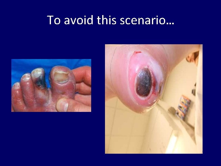 To avoid this scenario… 