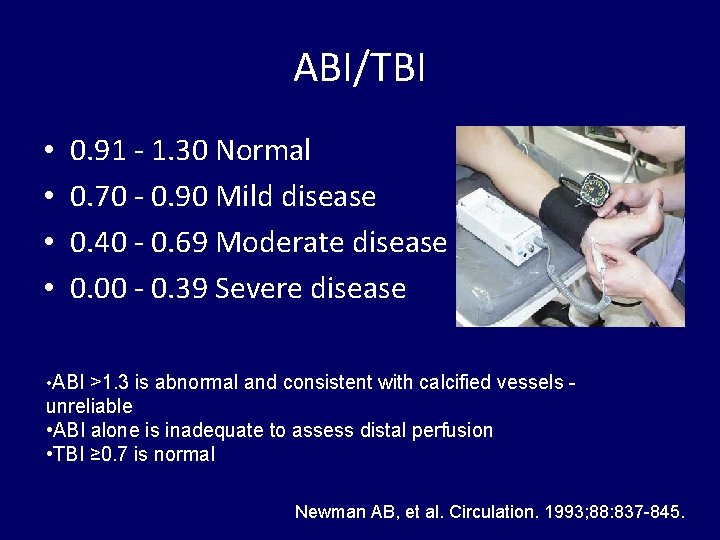 Pitfalls of ABI In critical limb ischemia Gholam