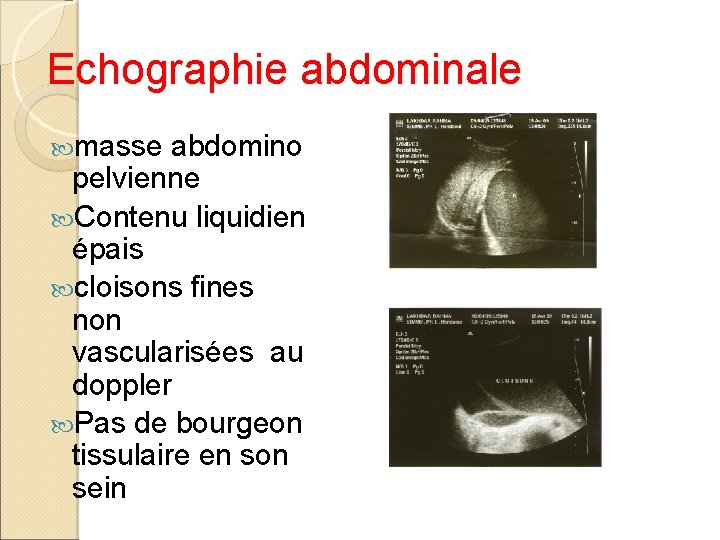 Echographie abdominale masse abdomino pelvienne Contenu liquidien épais cloisons fines non vascularisées au doppler