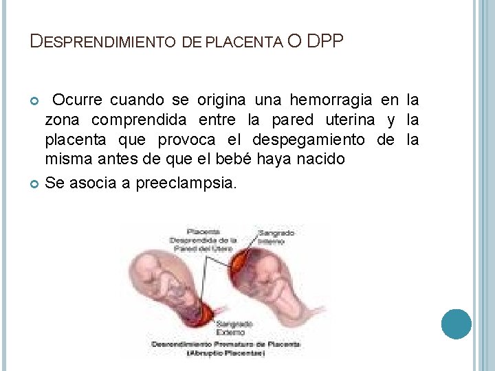 DESPRENDIMIENTO DE PLACENTA O DPP Ocurre cuando se origina una hemorragia en la zona