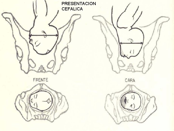 PRESENTACION CEFALICA 