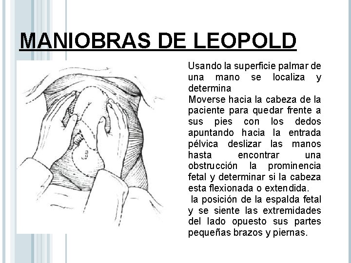MANIOBRAS DE LEOPOLD Usando la superficie palmar de una mano se localiza y determina