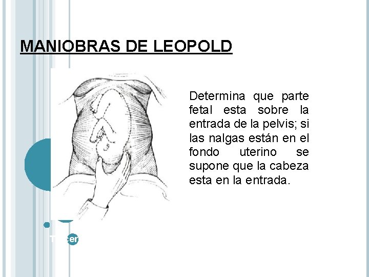 MANIOBRAS DE LEOPOLD Determina que parte fetal esta sobre la entrada de la pelvis;