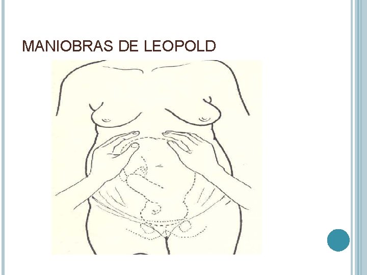 MANIOBRAS DE LEOPOLD 