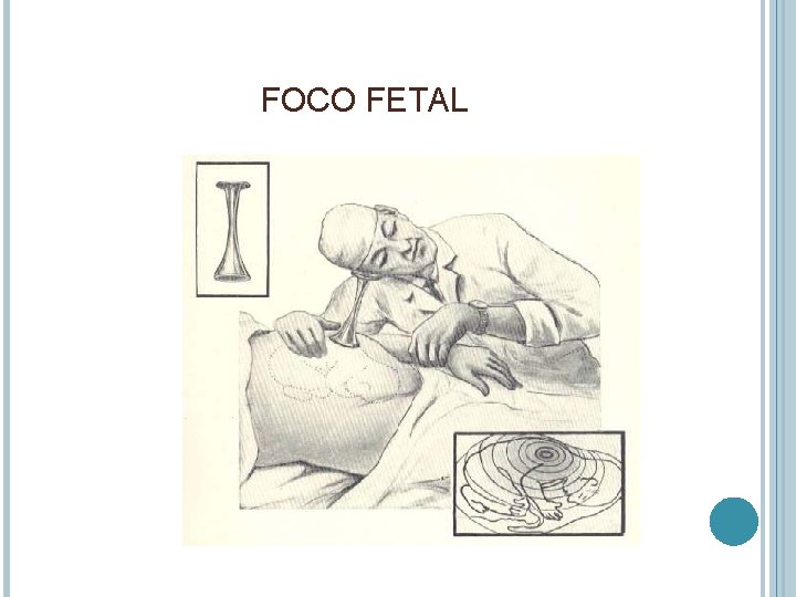 FOCO FETAL 