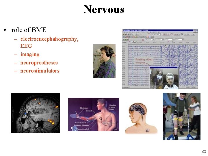 Nervous • role of BME – electroencephahography, EEG – imaging – neuroprostheses – neurostimulators