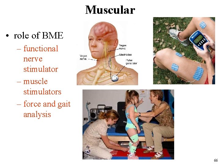 Muscular • role of BME – functional nerve stimulator – muscle stimulators – force