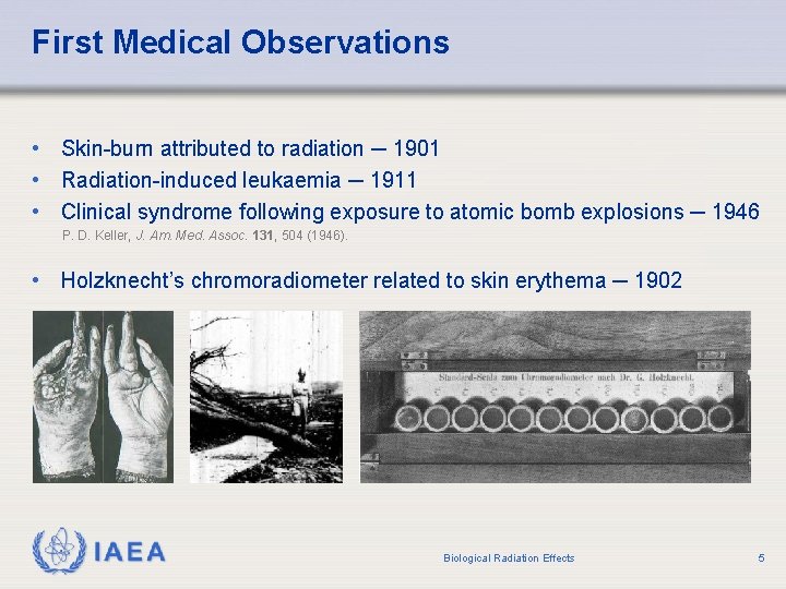 First Medical Observations • Skin-burn attributed to radiation ─ 1901 • Radiation-induced leukaemia ─