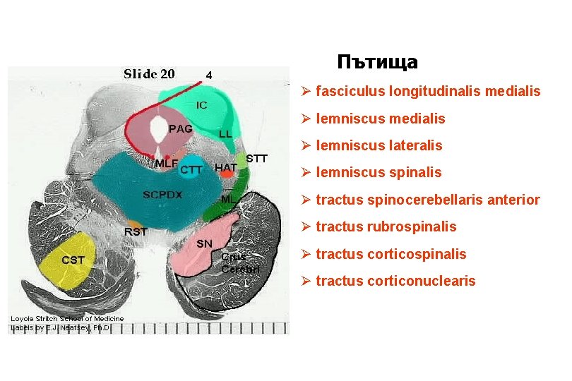 Пътища Ø fasciculus longitudinalis medialis Ø lemniscus lateralis Ø lemniscus spinalis Ø tractus spinocerebellaris Пътища Ø fasciculus longitudinalis medialis Ø lemniscus lateralis Ø lemniscus spinalis Ø tractus spinocerebellaris