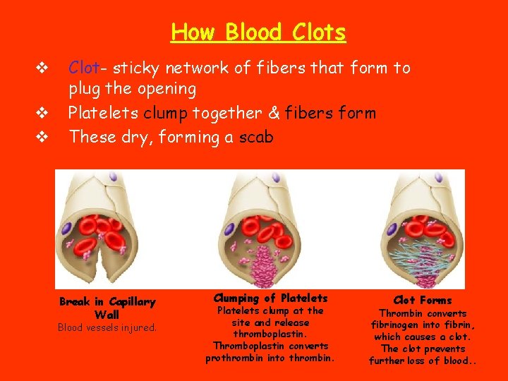 How Blood Clots v v v Clot- sticky network of fibers that form to