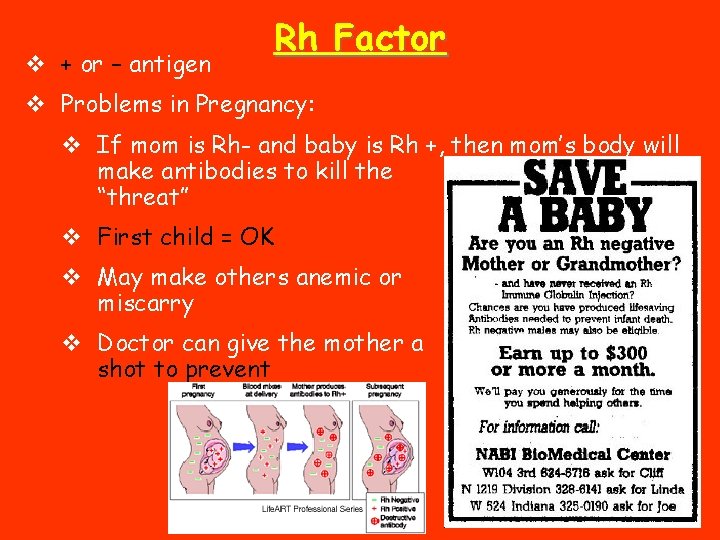 v + or – antigen Rh Factor v Problems in Pregnancy: v If mom