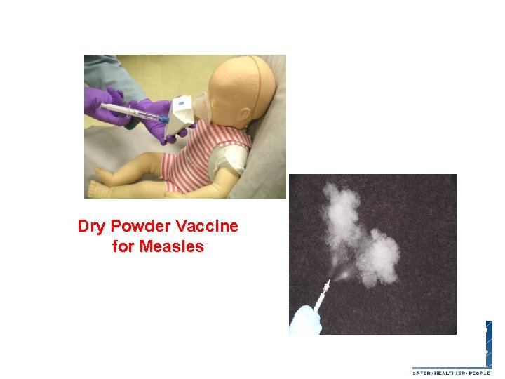 Dry Powder Vaccine for Measles 