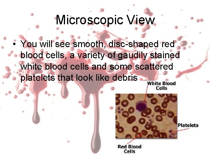 Microscopic View • You will see smooth, disc-shaped red blood cells, a variety of