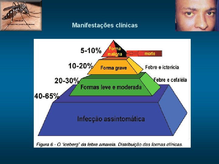 Manifestações clínicas 