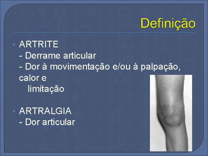  • ARTRITE - Derrame articular - Dor à movimentação e/ou à palpação, calor