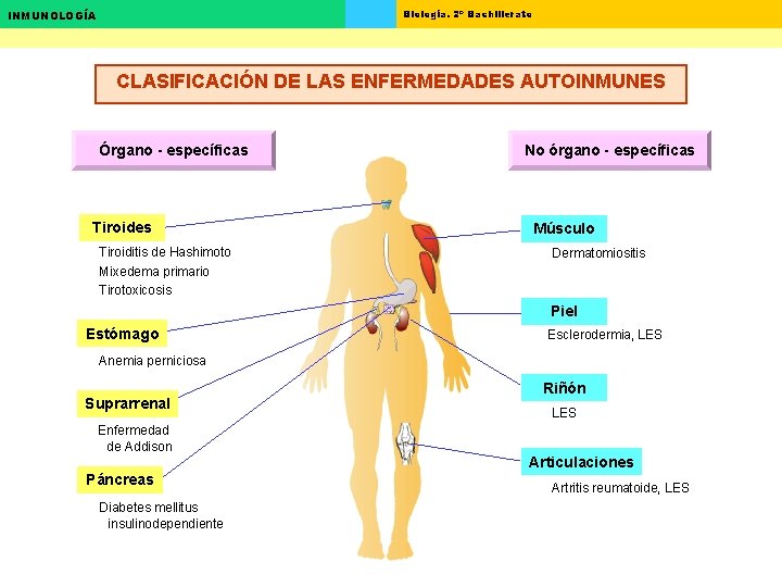 Biología. 2º Bachillerato INMUNOLOGÍA CLASIFICACIÓN DE LAS ENFERMEDADES AUTOINMUNES Órgano - específicas Tiroides Tiroiditis Biología. 2º Bachillerato INMUNOLOGÍA CLASIFICACIÓN DE LAS ENFERMEDADES AUTOINMUNES Órgano - específicas Tiroides Tiroiditis