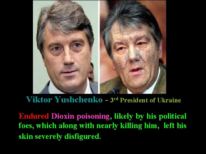 Dioxin poisoning Viktor Yushchenko - 3 rd President of Ukraine Endured Dioxin poisoning, likely Dioxin poisoning Viktor Yushchenko - 3 rd President of Ukraine Endured Dioxin poisoning, likely