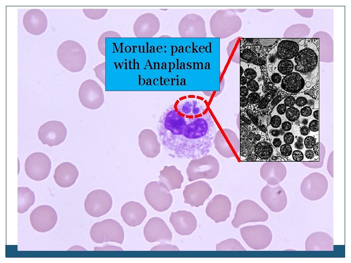 Morulae: packed with Anaplasma bacteria Morulae: packed with Anaplasma bacteria