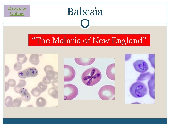 Return to Outline Babesia “The Malaria of New England” Return to Outline Babesia “The Malaria of New England”