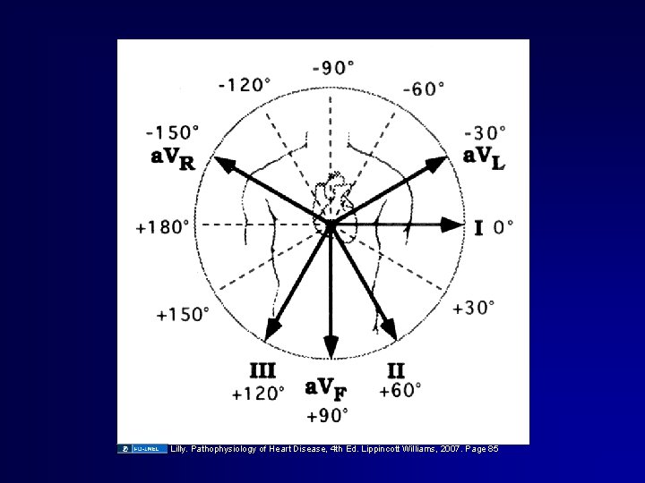 Lilly. Pathophysiology of Heart Disease, 4 th Ed. Lippincott Williams, 2007. Page 85 