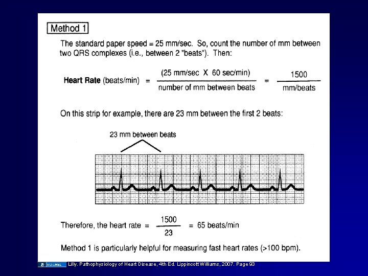 Lilly. Pathophysiology of Heart Disease, 4 th Ed. Lippincott Williams, 2007. Page 93 