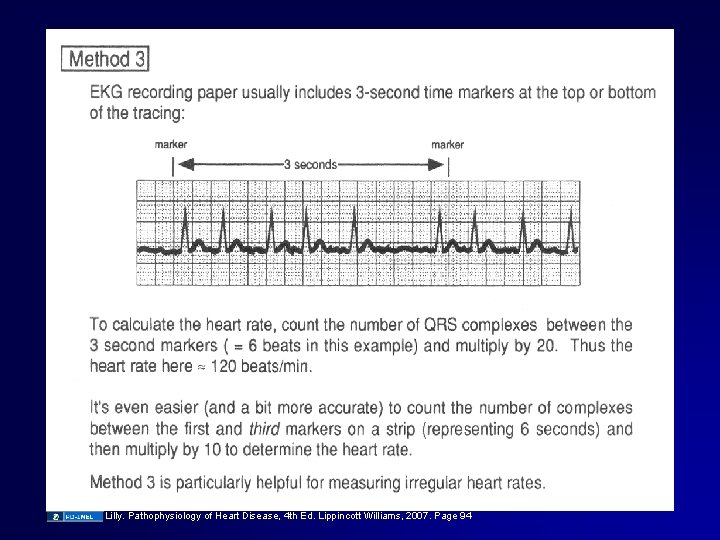 Lilly. Pathophysiology of Heart Disease, 4 th Ed. Lippincott Williams, 2007. Page 94 